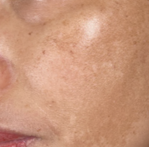 Before/After Image